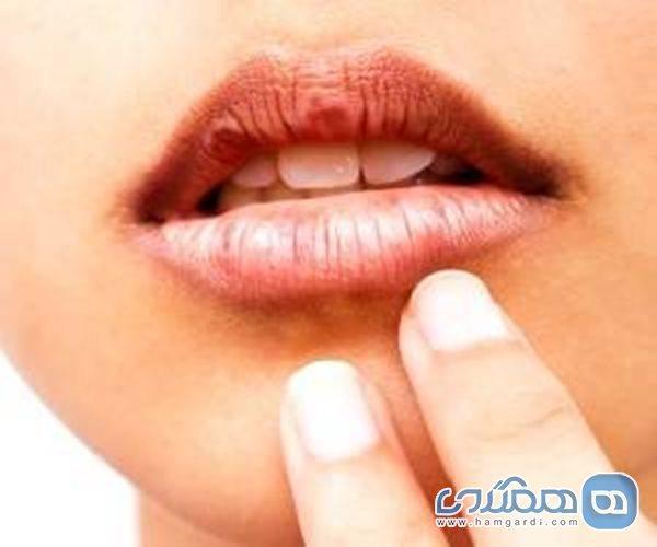 آنچه دهان دیابتی ها را خشک میکند