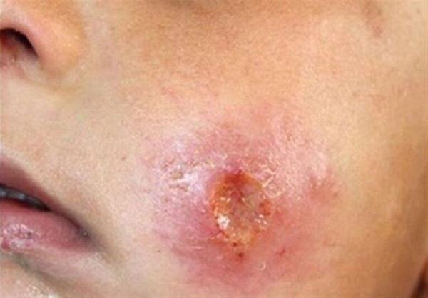 پاسخ به 9 پرسش رایج درباره سالک